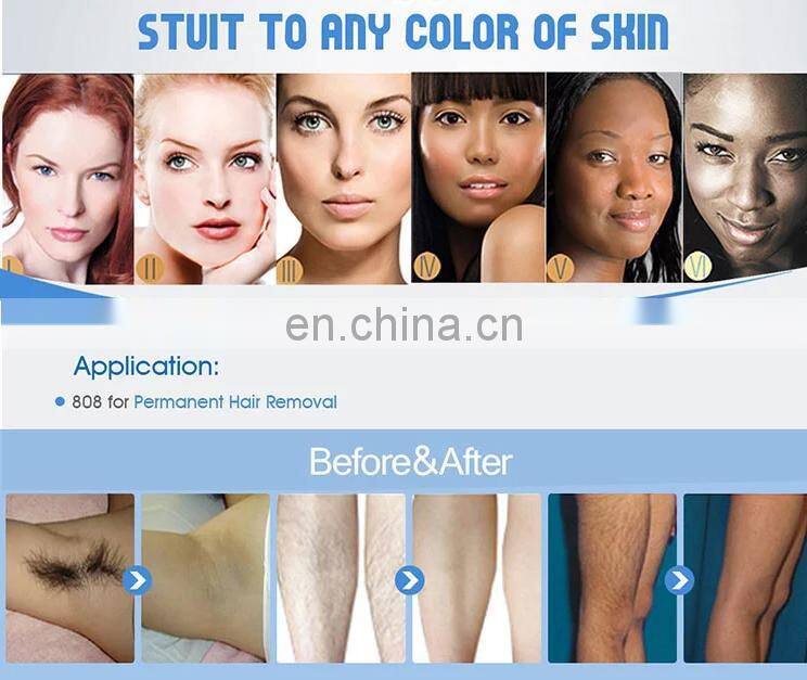 Professional 3 waves soprano hielo platino laser hair removal machine cabezal laser diodo soprano