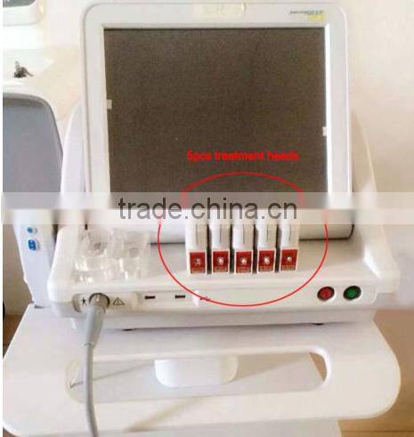 Mini HIFU anti wrinkle machine best selling products 2016 in USA