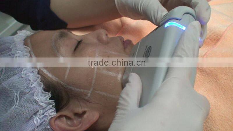 HIFU Ultrasound Vacuum Body Shaping Machine For Weight Loss