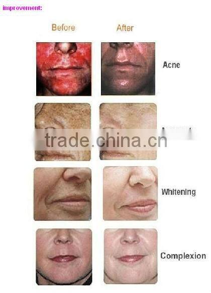 oxygen water machine/jet machine/oxygen facial machine home use