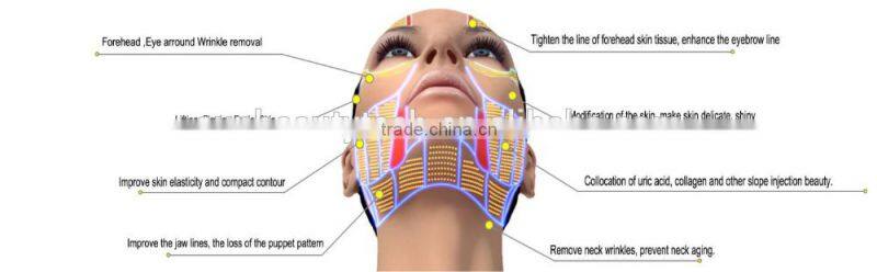 Home use Ultra lift HIFU korea