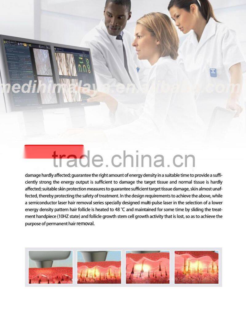 Advanced diode laser hair removal 2016 portable laser machine