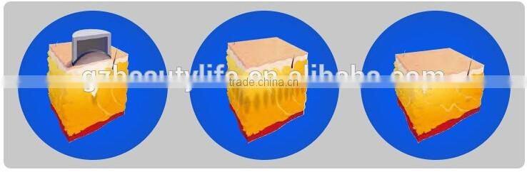 Lose belly fat quickly/ New tech of 13mm depth HIFU reduce fat at once