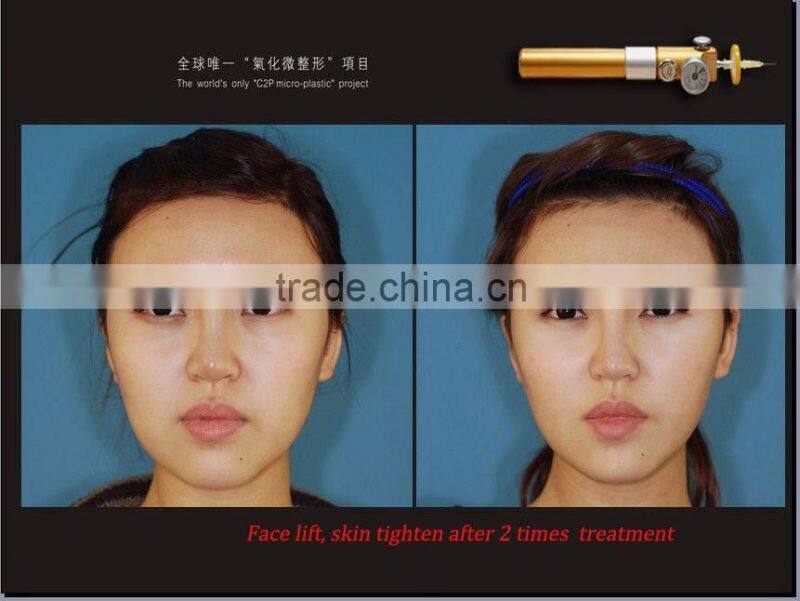 2016 Most popular CDT skin care equipment !!