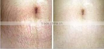 derma cosmetic china derma roller microneedle L005 540 nmm