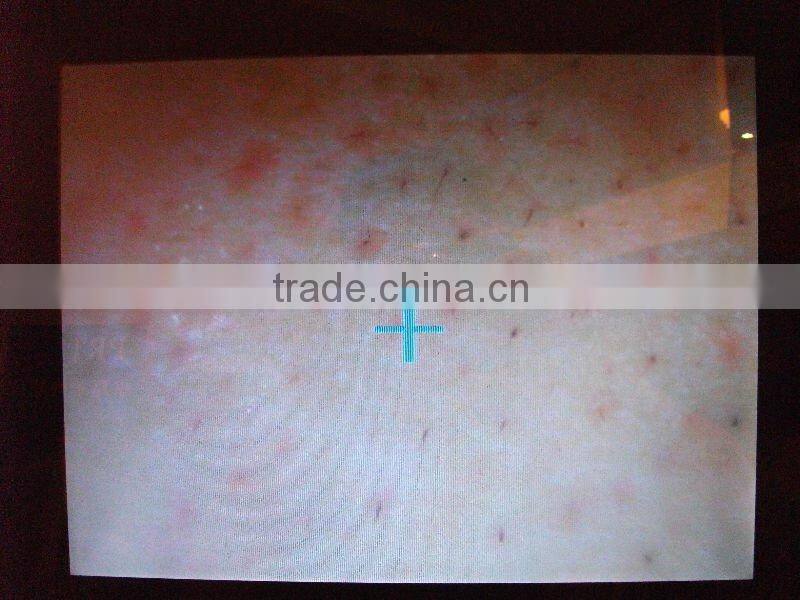 beauty equipment machine