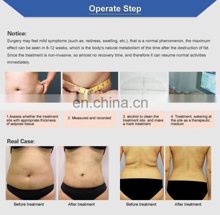 Newest beauty hifu slimming machine price ultrasound hifu equipment for sale