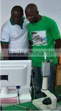 advanced digital electronic colposcope with new design