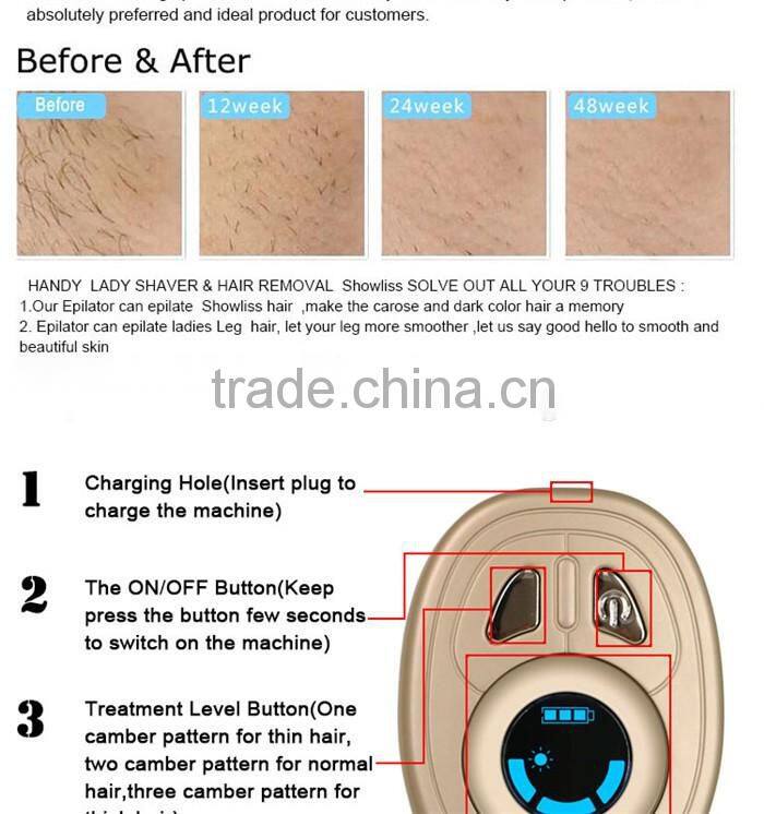 Comes with battery hair removal instrument for mobile beauty salon equipment