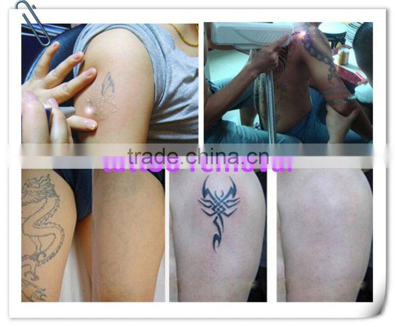 Best desktop Q swith nd yag Laser tattoo removal beauty machine