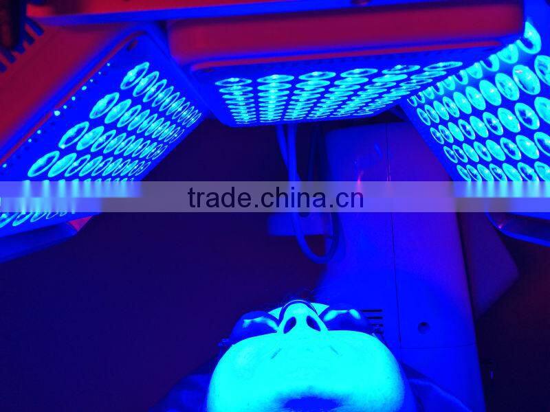 Apolomed PDT LED Acne treatment by led blue light therapy