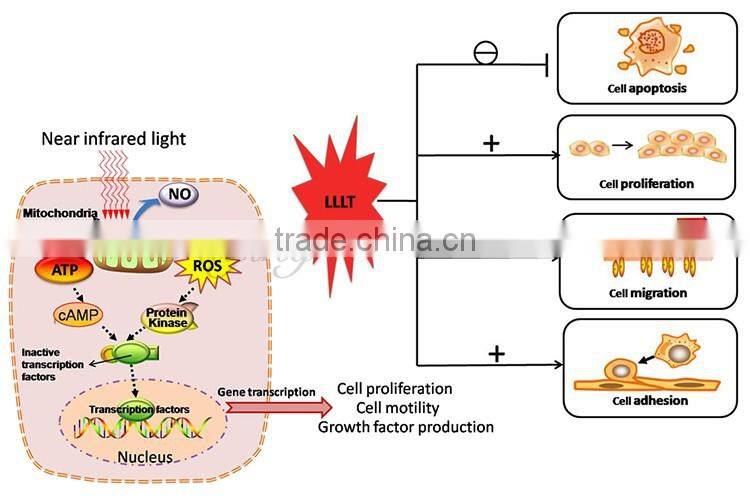4 color PDT machine photo dynamic therapy pdt