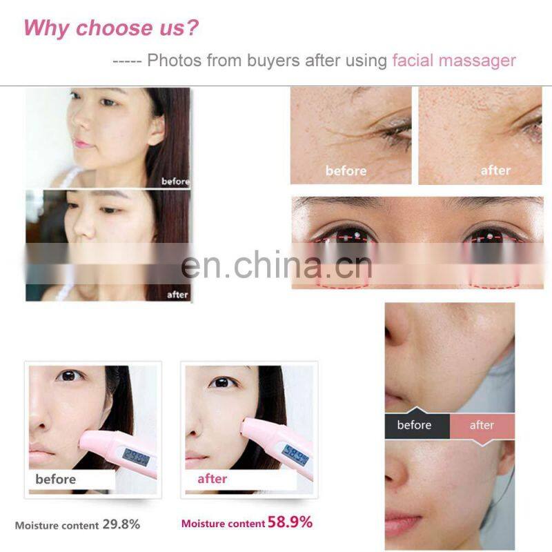 Home Use Electric Multifunction Rf Face Lifting Device