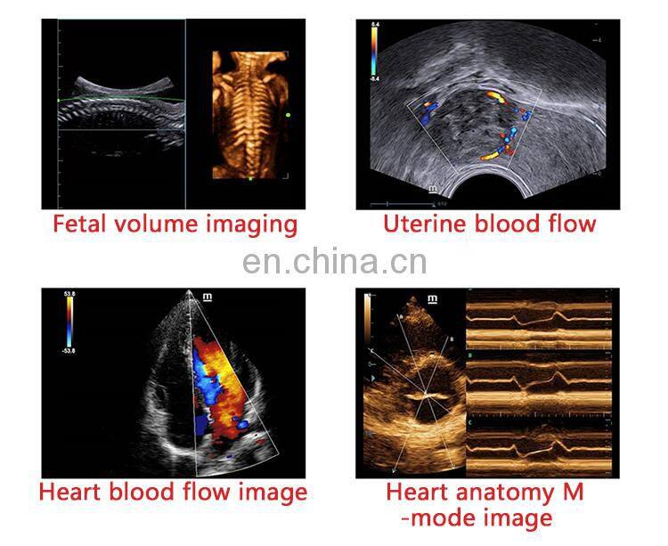 Best-selling Trolley Mindray dc-40 color doppler ultrasound machine portable Mindray ultrasound device