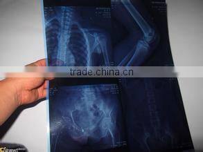 medical film thermal meter printer Medical laser paper film