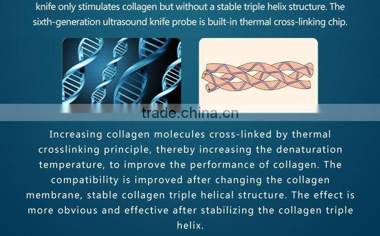 No bleeding face lifting machine home hifu treatment