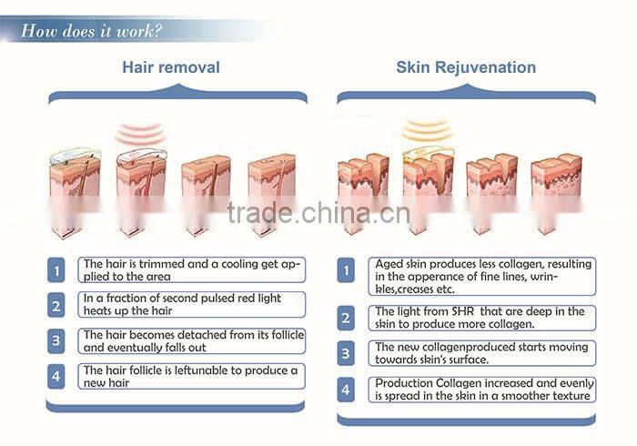 two handles shr ipl diode laser hair removal machine price