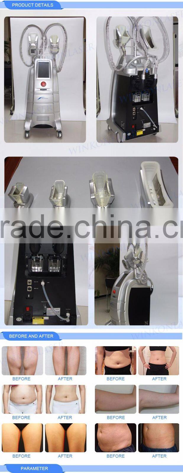 Hot selling 4 handles treatment handles newest slimming cryolipolysis machine