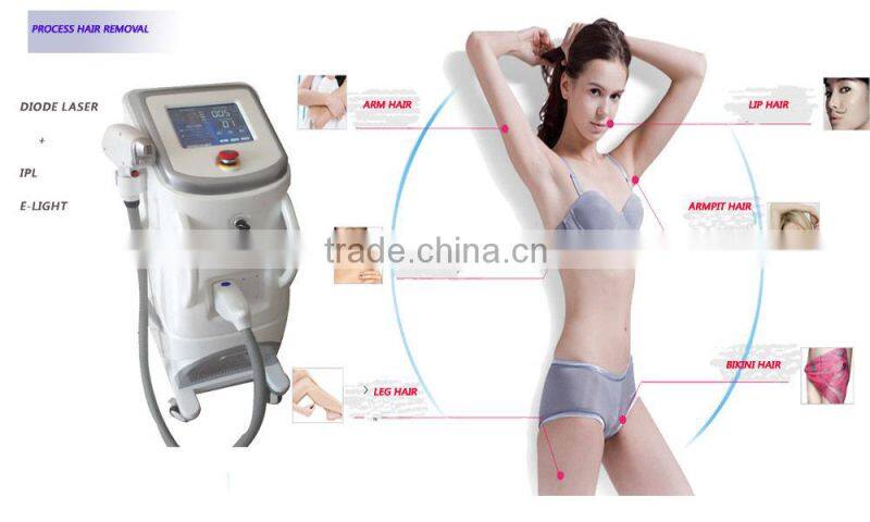 Painless 808nm diode laser hair removal