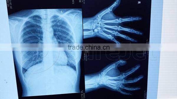 HD Medical Film Special Ink