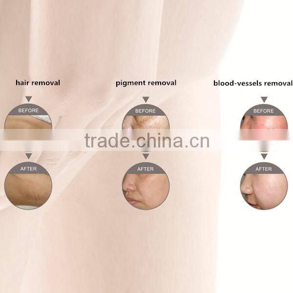 vertical hair remove andskin rejuvenation opt beauty machine/ipl shr machine