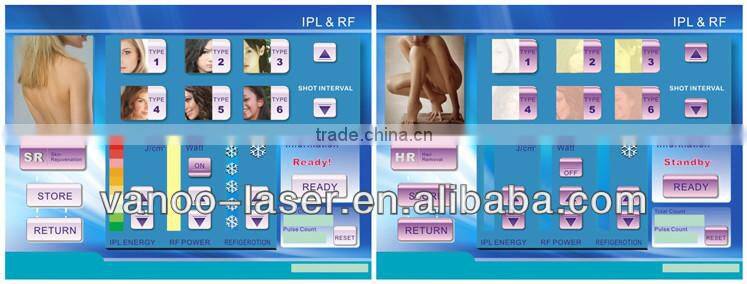 Acne Treatment ipl rf E-light beauty equipment