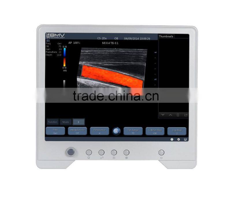 phased array probe touch screen color doppler software 3d ultrasound