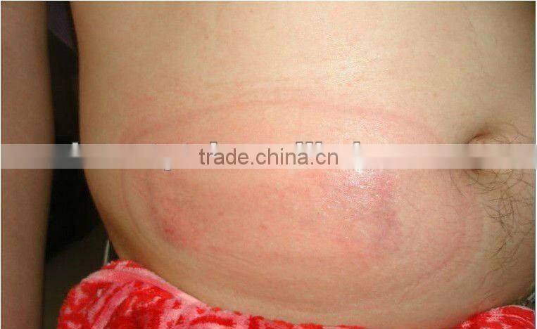 Hot Sale! criolipolisys beauty salon equipment