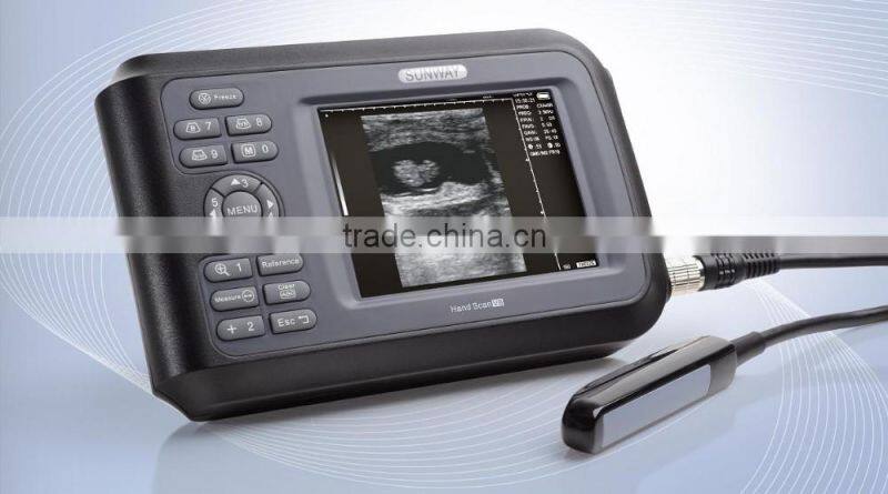 2016 Best Palm handheld ultrasound scanner ultrasound & palm ultrasound ultrasonic diagnostic insturements-V8