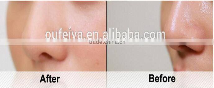 silicone facial cleansing brush