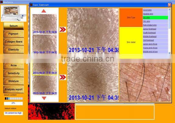 AYJ-J019 skin&hair analyzer facial reveal imager skin analyzer