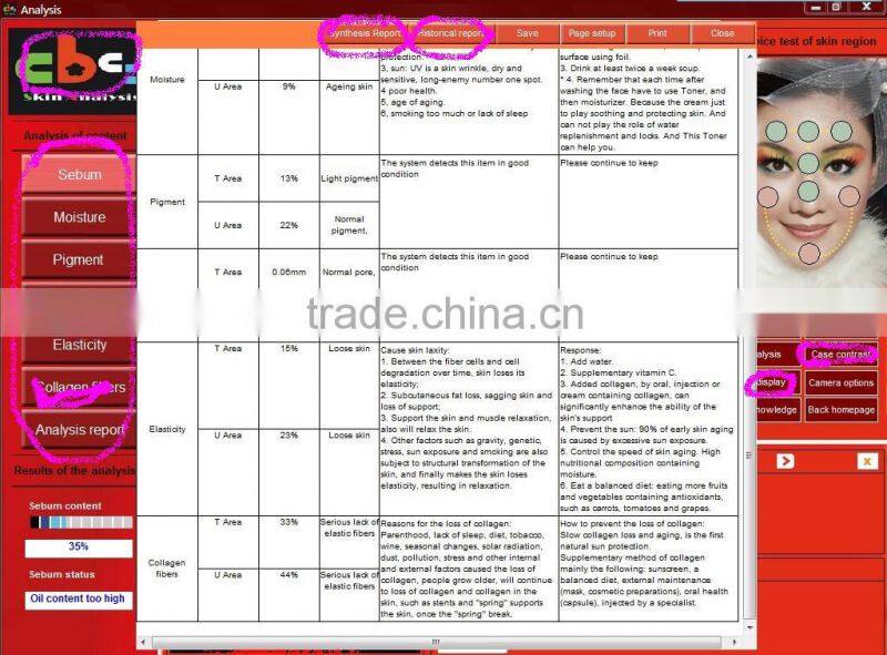 CE approved professional digital skin analyzer