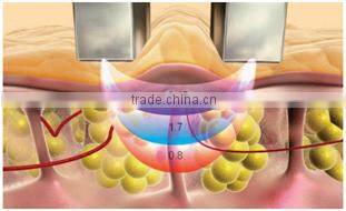 Weight Loss Spa 5IN1 Cavitation Vacuum RF Cooling Vacuum System Slimming Machine