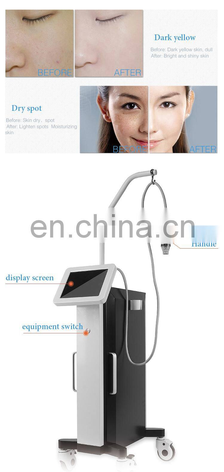 Renlang RF Device Series Micro Crystal Technology RF Microneedle Non-invasive Skin Care Equipment Vertical