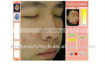Mirror System/Skin Analyser Machine
