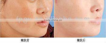 BFP-4000 Professional 3IN1 multi functional IPL machine