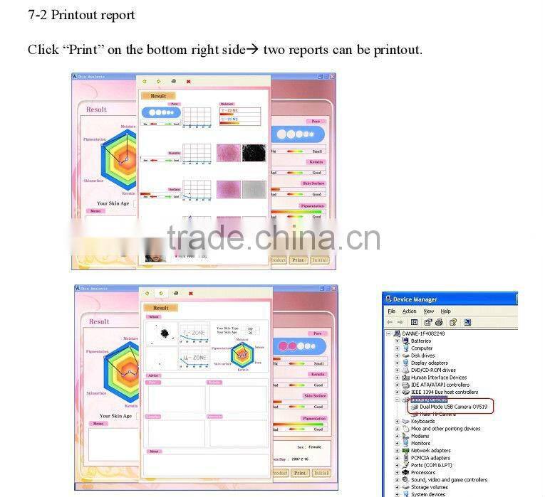 hot sale visia skin analysis machine HT-907
