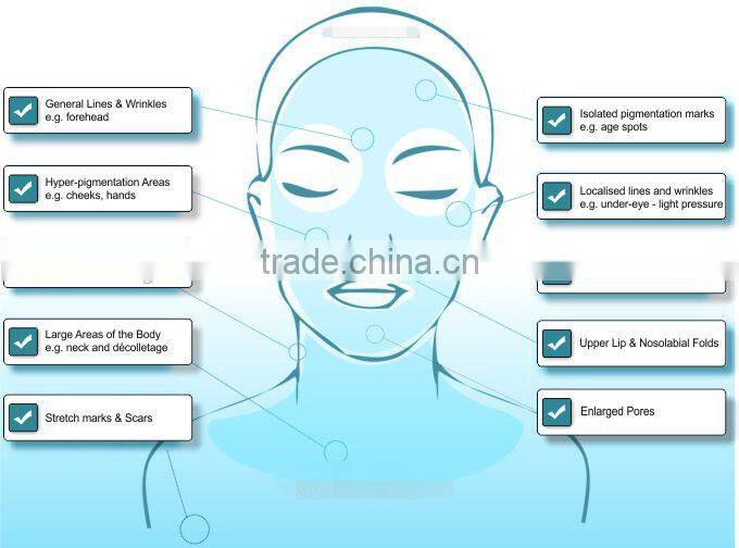 Medical grade derma roller/stainless steel derma roller