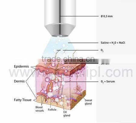 Oxygen water facial skin care jet peel facial equipment wholesale