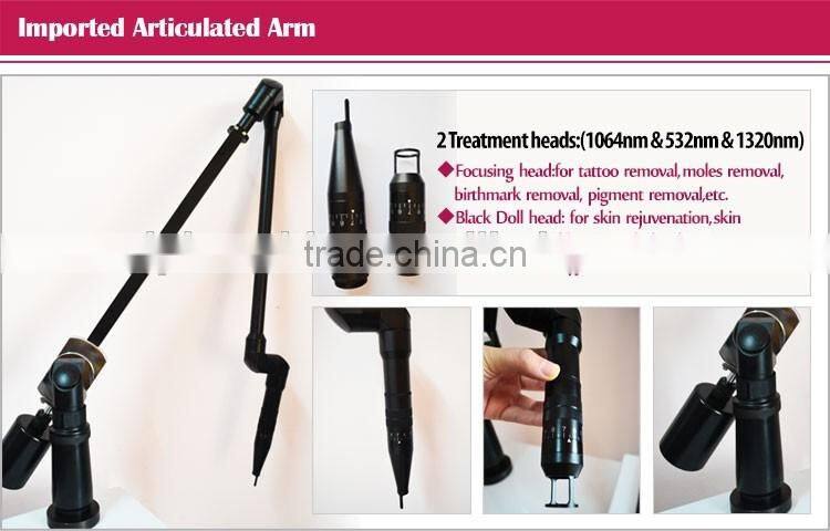 Good feedback tattoo removal q-switch nd yag laser