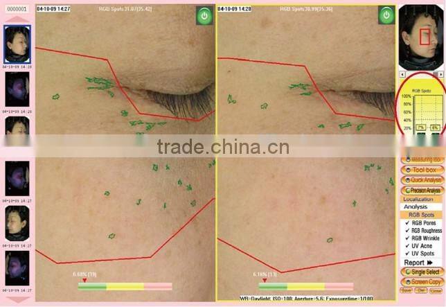 hot sell magic mirror facial skin analyzer / 3d face camera