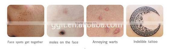 2016 new designed liquid plasma pen for tattoo removal pen for laser co2 spots removal pen