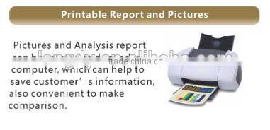 Handheld Intelligent Facial Skin Scanner Analyzer