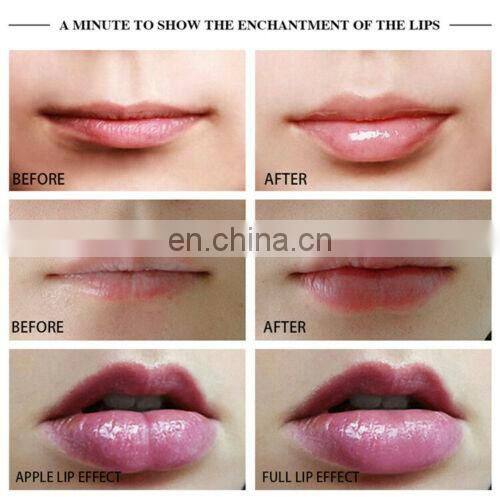 New Bigger Lips Plumper Filler Enlargement Enlarge Augmentstion Pump Machine