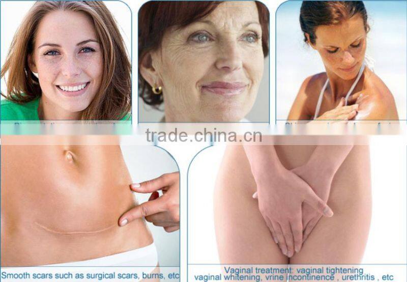 Golden Supplier Warts Cutting Skin Vaginal Tightening Co2 Fractional Laser