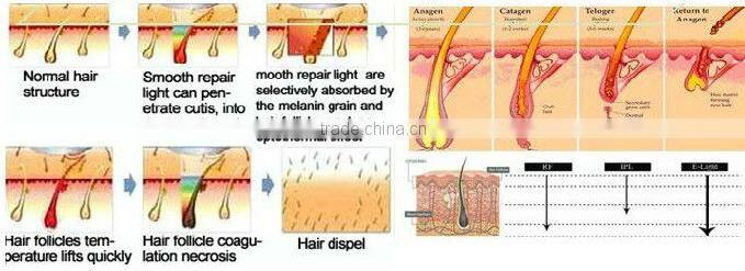 2015 factory promotion!!!!!!! Permanent opt hair removal ipl shr ssr machine