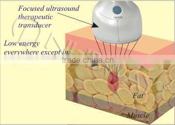 World most advanced latest HIFUSHAPE hifu transducer for body slimming body shaping weight loss