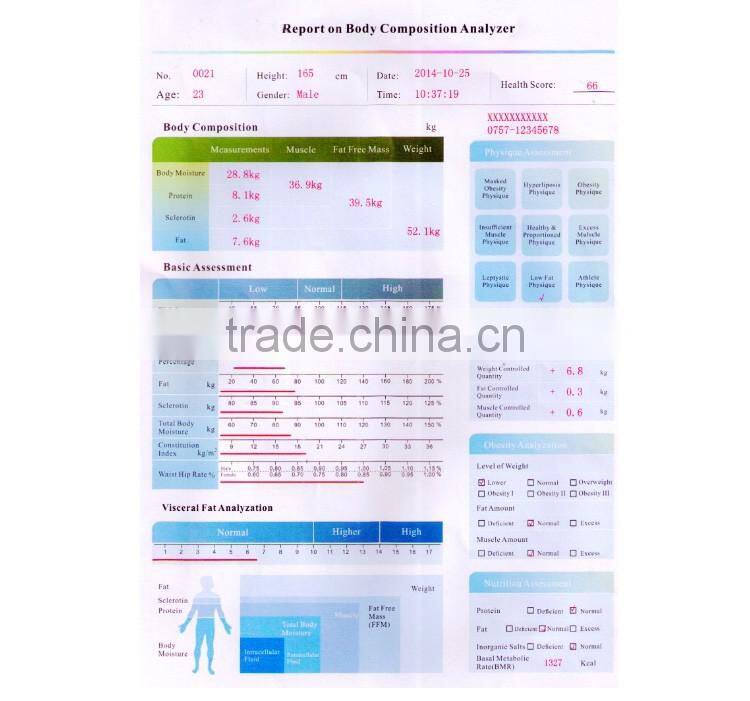 Professional body composition analysis machine/body analyzer machine