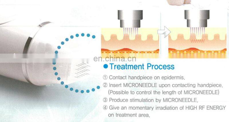 Micro-needle fractional RF machine