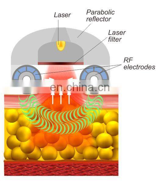 Osano V10 velashape vacuum massage sculptor body lipo vacuum osana v10 velashape